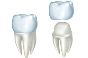 Dental crowns